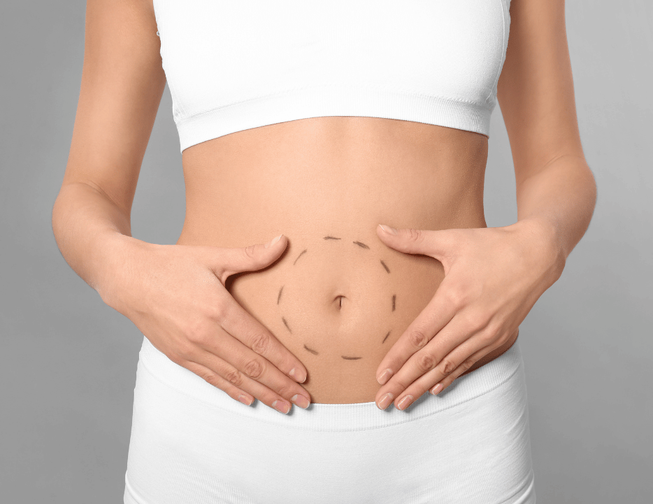 Eine Frau, welche zur Bauchdeckenstraffung beraten wird.